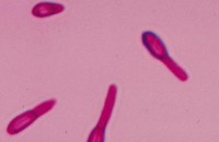 ИХТ "Tetanus Тест" для выявления антитоксиновых столбнячных антител в сыворотке и цельной крови человека (20 кассет)