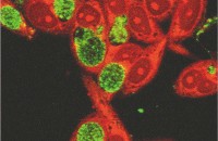 ИХТ «Chlamydia ТЕСТ» для  выявления антигенов Chlamydia trachomatis в урогенитальных образцах и соскобе с конъюктивы (20 кассет)