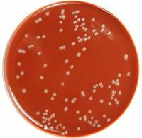 ИХТ «Гонорея Тест» для  выявления антигенов Neisseria gonorrhoeae в урогенитальных образцах и моче (20 кассет)