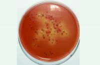 Желчный агар с кристаллвиолетом, глюкозой и нейтральным красным [VRBD] (соотв. EP/USP/JP), 500 г