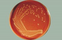 Стимулятор роста гемофильных микроорганизмов (СРГМ), сухой, 10х0,1 кг