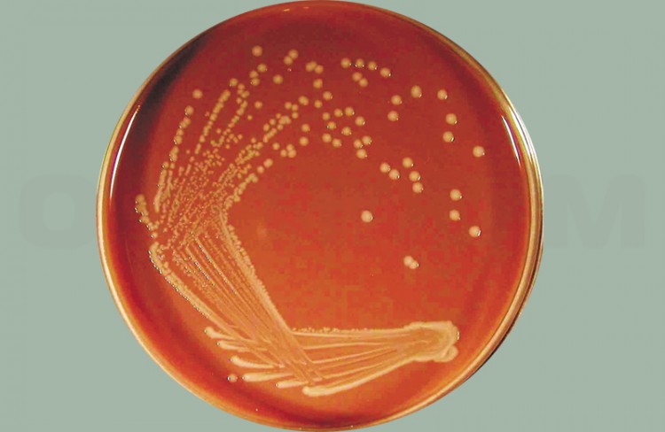 Стимулятор роста гемофильных микроорганизмов (СРГМ), сухой, 10х0,1 кг