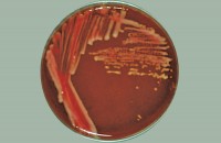 Кампилобактериозный агар с 7,5% ДОК / Кампилобактериозный бескровный агар по Престону, готовые, в двухсекционной чашке Петри 90 мм