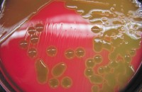 Стрептококковый кровяной агар / Кровяной Агар (Триптозо-Соевый агар с  5% ДОК), готовые, в двухсекционной чашке Петри 90 мм