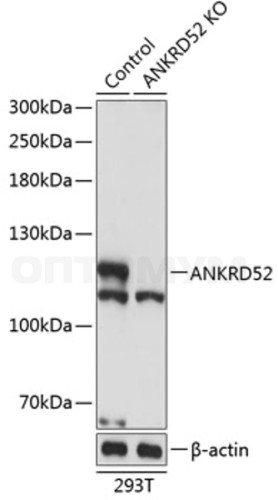 Антитела [KO Validated] ANKRD52 кроличьи, поликлональные, ABclonal