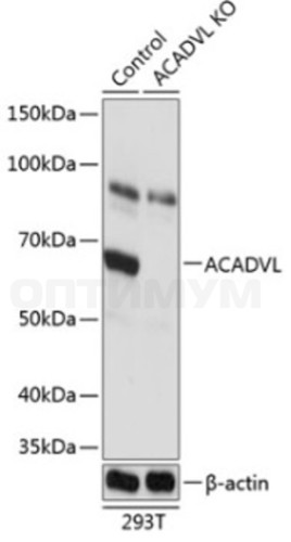 Антитела [KO Validated] ACADVL кроличьи, поликлональные, ABclonal