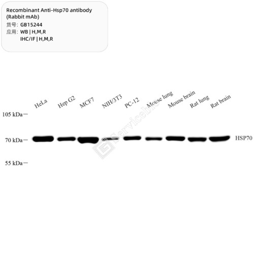 Антитела Anti-Hsp70 Rabbit pAb, кроличьи, рекомбинантные, Servicebio, Китай
