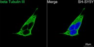 Антитела Anti-Rabbit IgG (H+L) козьи, поликлональные, коньюгированые с ABflo 408, ABclonal