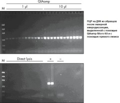 Набор для выделения ДНК из биологических образцов малого объема QIAamp DNA Miсro Kit, Qiagen