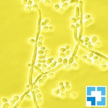 Зимолиаза 100T из Arthrobacter luteus, лиофильный порошок, 100 000 ед/г, MP Biomedicals
