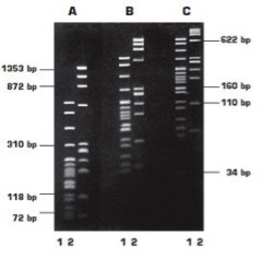 Агароза, низкий EEO, LM Sieve, легкоплавкая, Genetic Quality Tested, diaGene