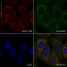 Антитела Recombinant Anti-Glypican 1/ GPC1, 100 мкл, Abcam