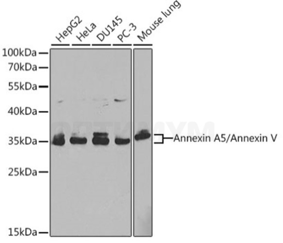 Антитела [KO Validated] Annexin A5/Annexin V кроличьи, поликлональные, ABclonal