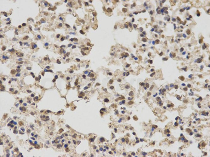 Антитела anti-PKM1/2 antibody, кроличьи поликлональные, Arigobio