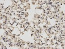 Антитела anti-PKM1/2 antibody, кроличьи поликлональные, Arigobio